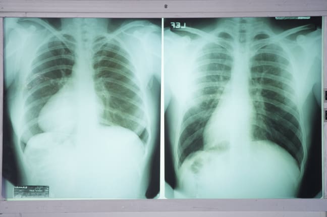 A picture of two different types of x-rays.